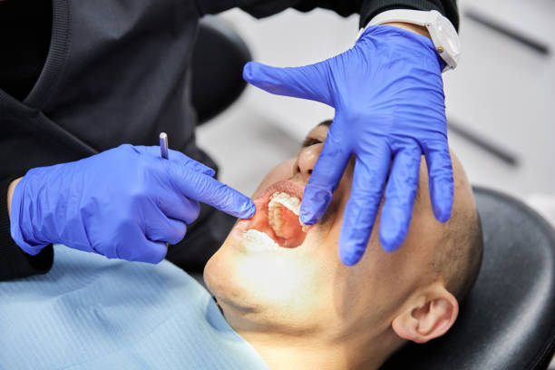 Best Emergency Dentist for Knocked-Out Tooth in Wyandanch, NY